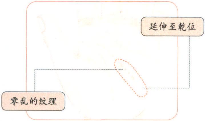 反映心腦、神經(jīng)系統(tǒng)健康——2線